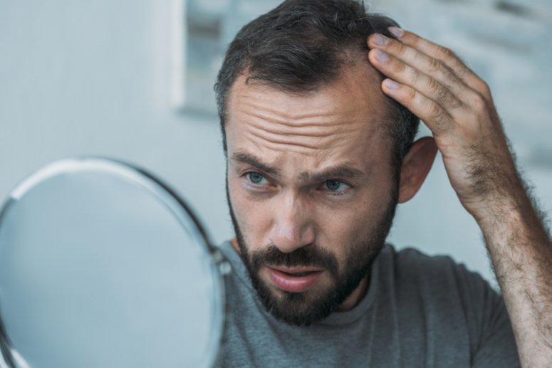 can autism cause hair loss